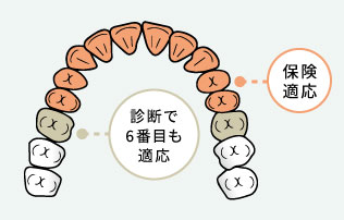 保険適用箇所