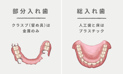 部分入れ歯/総入れ歯