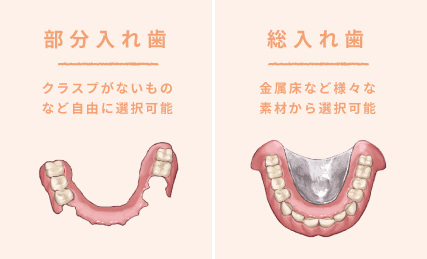 部分入れ歯/総入れ歯