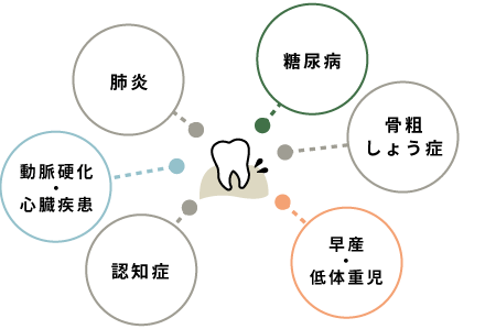 糖尿病、骨粗しょう症、早産・低体重児、認知症、動脈硬化・心臓疾患、肺炎